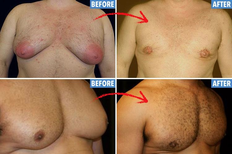 Excess Oestrogen — Don’t embrace your feminine side too much!